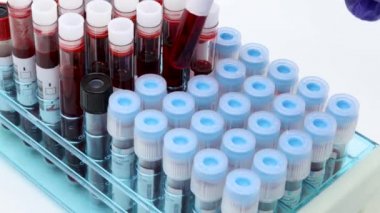 Cerrahi eldivenli doktor eli, test tüpleriyle dolu bir raftan kan test tüplerini kontrol ediyor. Salgın, COVID-19 test konsepti.