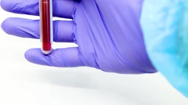 Kan testinin sonucuna göre hızla yayılan yeni Coronavirus için mavi eldivenli mikrobiyolog ya da tıp çalışanı eli yakından inceleniyor. COVID-19 Pozitif kavram