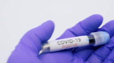 Mikrobiyolog ya da tıbbi çalışanın mavi eldivenli eli hızla yayılan koronavirüs için kan testinin pozitif çıktığını gösteriyor. COVID-19 Pozitif kavram