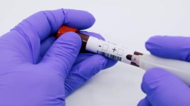 Kan testinin sonucunu hızla yayılan koronavirüs için pozitif gösteren mavi eldivenli mikrobiyolog ya da tıp çalışanı elinin yakınlaşması. COVID-19 Pozitif kavram