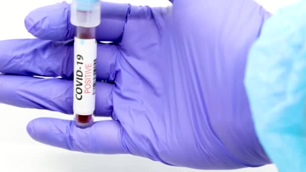 Kan Testinin Sonucuna Göre Hızla Yayılan Yeni Coronavirus Için Mavi — Stok video