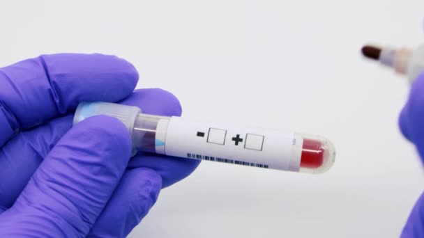 Mikrobiyolog Tıbbi Çalışanın Mavi Eldivenli Eli Kan Testinin Klamidya Için — Stok video