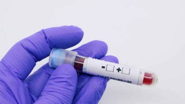 Mikrobiyolog Tıp Çalışanı Elinin Mavi Eldivenli Hali Kan Testinin Sonucunun — Stok video
