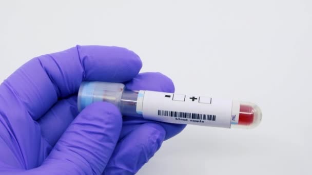 显微生物学家或医务工作者用蓝色手术手套在手上贴上血液检测结果呈阳性 黑人死亡 瘟疫阳性概念 — 图库视频影像
