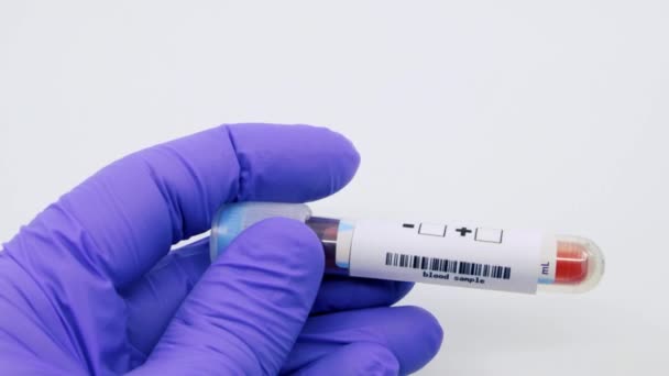 微生物学家或医务工作者手部用蓝色手术手套贴上血液检测结果呈阳性 小儿麻痹症阳性概念 — 图库视频影像