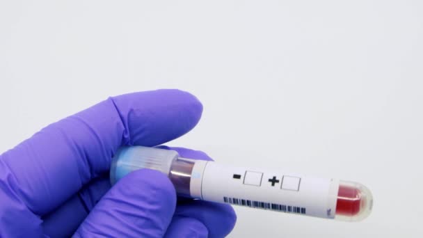 微生物学家或医务工作者手部用蓝色手术手套对梅毒进行的血液检测结果呈阳性 梅毒阳性概念 — 图库视频影像