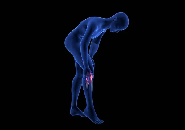 Knee Pain. Blue Human Anatomy Body 3D render on black background — Stock Photo, Image
