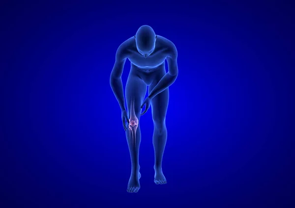 Knieschmerzen. blauer menschlicher Anatomie-Körper 3D-Rendering auf blauem Hintergrund — Stockfoto