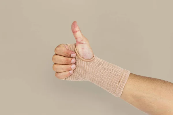 Τραυματίες γυναικείο χέρι δείχνει τον αντίχειρα επάνω — Φωτογραφία Αρχείου
