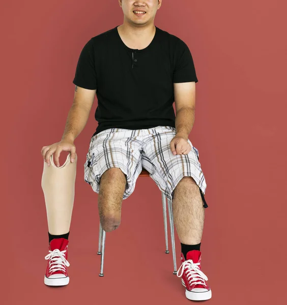 Jovem deficiente — Fotografia de Stock