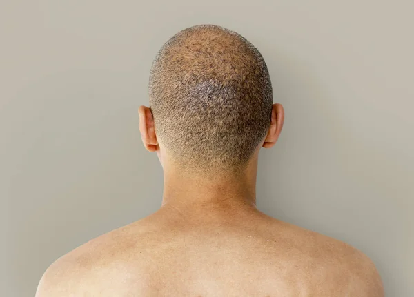 Bald man head — Stock Photo, Image