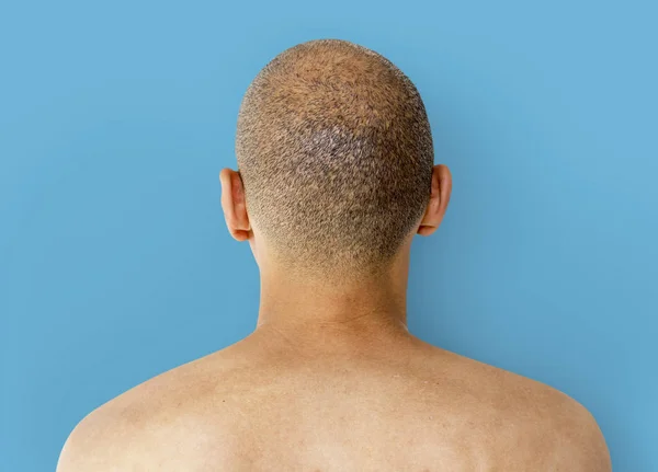 Cabeça careca — Fotografia de Stock