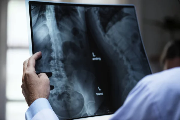 Ein Arzt Mit Dem Röntgenfilm Eines Patienten Originalfotos — Stockfoto