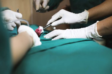 Doktorlar ameliyat yapıyorsun orijinal photoset