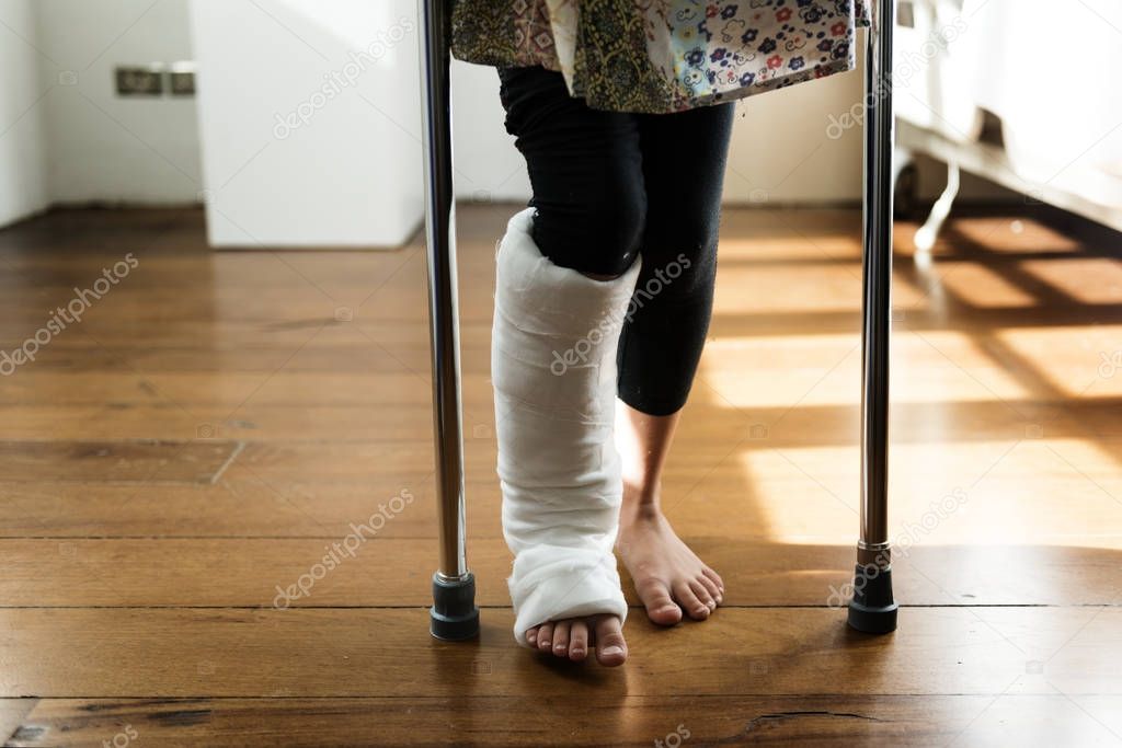 Young girl with broken leg in plaster cast, original photoset
