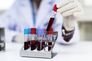 Kontrol kan örnekleri, özgün photoset doktor