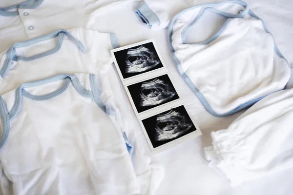 Baby Scan Met Baby Kleding Bed Originele Photoset — Stockfoto