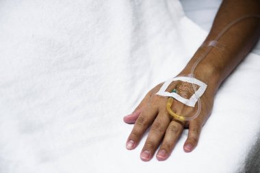 El ile IV tüp, özgün closeup photoset