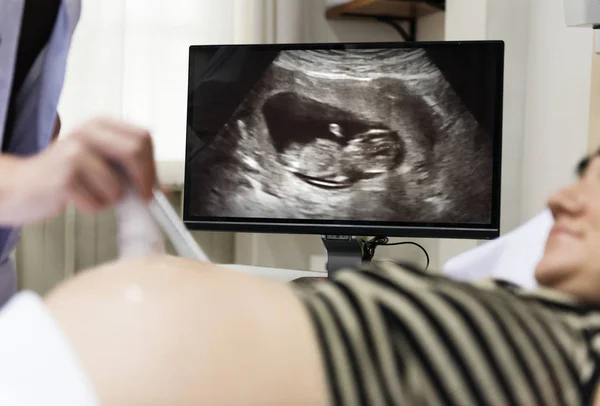 Беременная Женщина Триместра Оригинальный Фотосет — стоковое фото