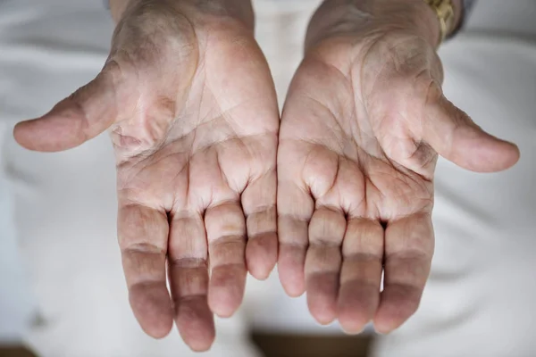 Closeup of elderly hand palms