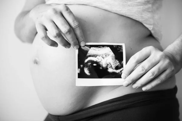 Hamile Kadın Gösteren Cenin Ultrason Fotoğraf Siyah Beyaz — Stok fotoğraf