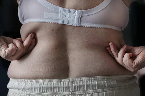 Primo Piano Della Donna Anziana Obesa — Foto Stock