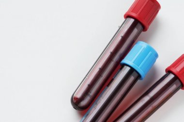Kan tüp testi closeup