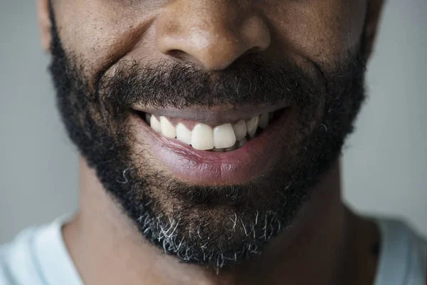 Fechar Dentes Sorridentes Homem Negro — Fotografia de Stock