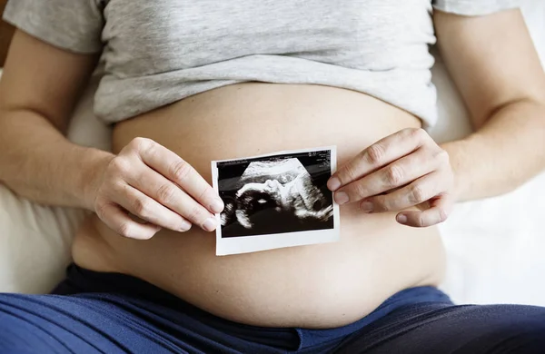 Gravid Kvinna Visar Fostret Ultraljud Foto — Stockfoto