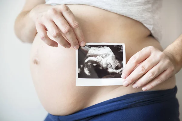 Беременная Женщина Ультразвуковым Снимком Плода — стоковое фото