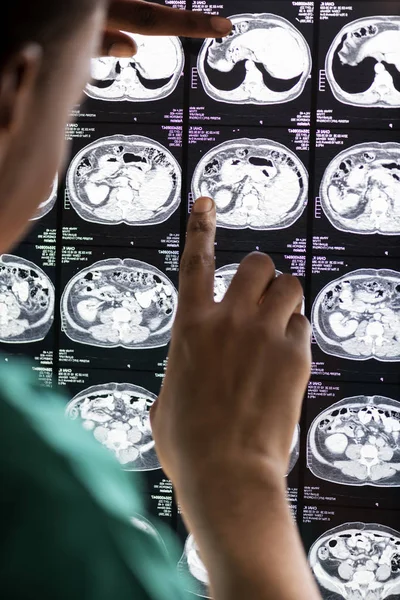 Arzt Liest Röntgenbild Des Gehirns — Stockfoto
