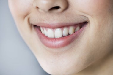 Close up portrait of Young Asian girl teeth smiling clipart