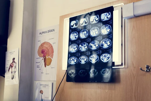 Röntgenbilder Der Wand — Stockfoto