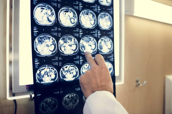 Gehirn Röntgen Film — Stockfoto