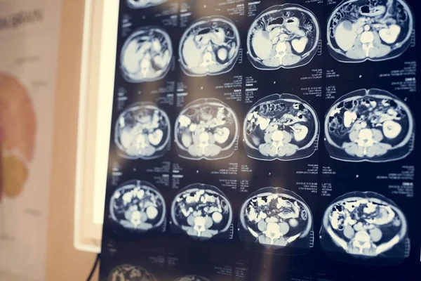 Tomografía Computarizada Cerebral Radiografía — Foto de Stock
