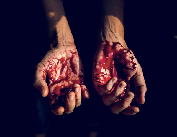 Severely Injured Bloody Hands Partial View — Stock Photo, Image