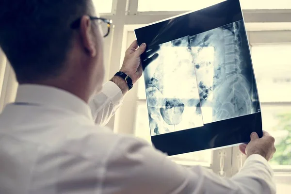 Γιατρός Ελέγχει Ασθενής Ακτινογραφία Ταινία — Φωτογραφία Αρχείου