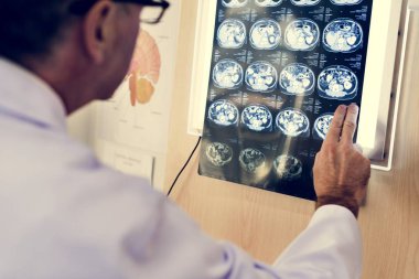 Doktor kontrol x-ray sonuçları