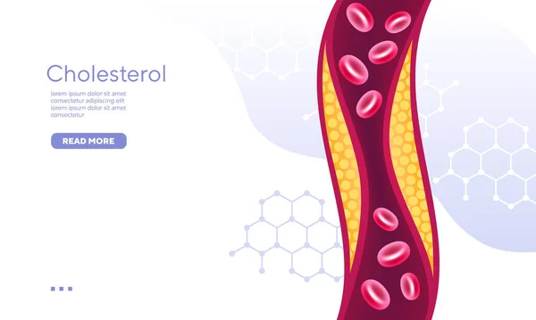 Compuesto Orgánico Rojo Sangre Colesterol Vector Ilustración — Archivo Imágenes Vectoriales