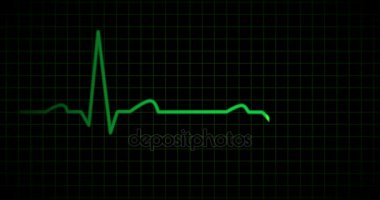 EKG veya EKG çizgi yeşil