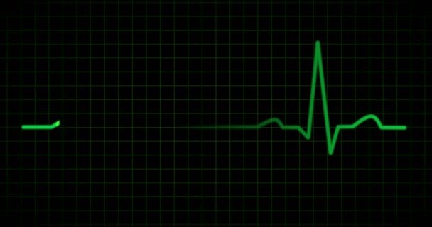 EKG veya EKG çizgi yeşil — Stok video