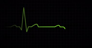 Ekg monitör yeşil kalp atışını