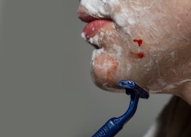 Closeup Man Shaving Razor Burn with blood. Man shaving using razor with cream foam. Guy removing face beard hair. Skin care and hygiene. Man was injured by a razor clipart