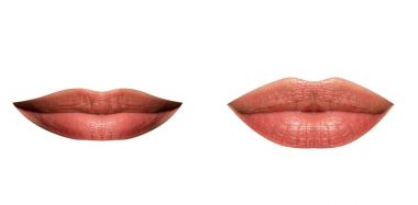 Dudaklar kadının ince ve tam, ayarlayın. Plastik dudak düzeltme. Botox ve hyaluronik asit. Gençlik, birimin dudak enjeksiyon enjeksiyonlari. Kız onu dudaklar büyük, güzellik ve makyaj yaptı