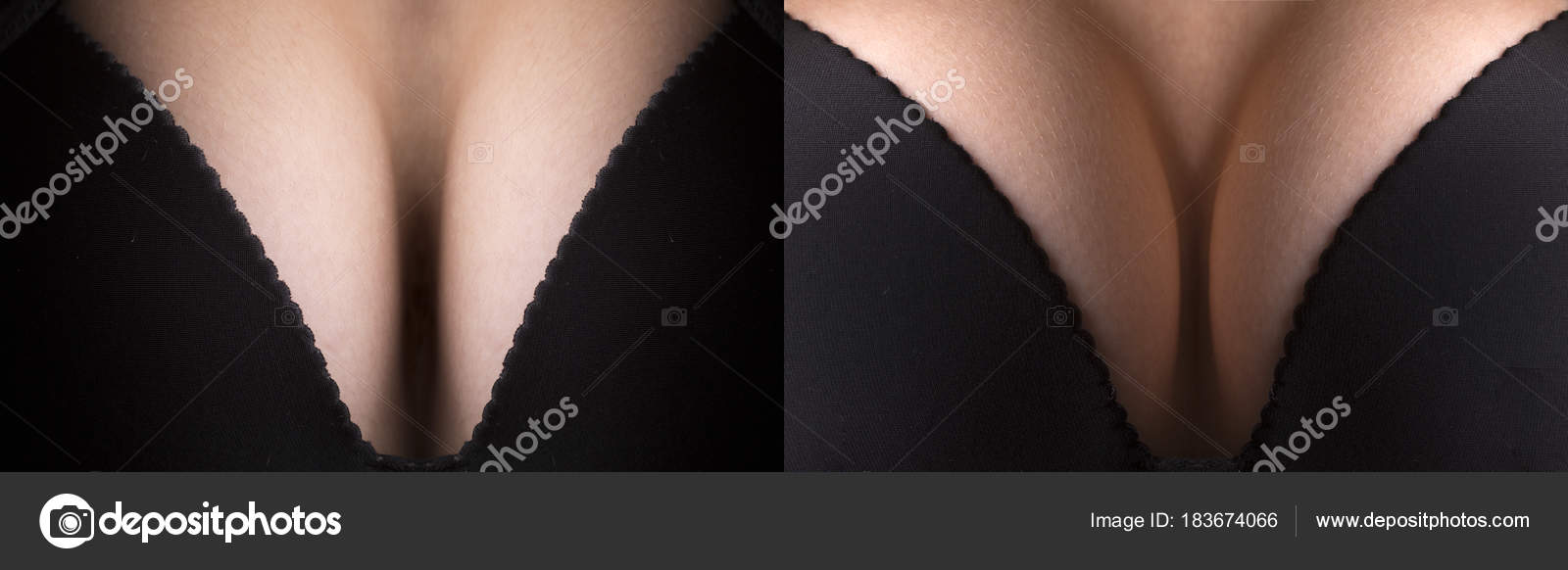 Velké stahování videa z prsu
