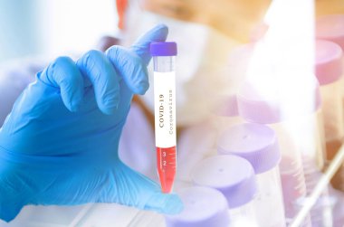 Coronavirus 2019 nCoV kan örneği. Aşı için laboratuvar .