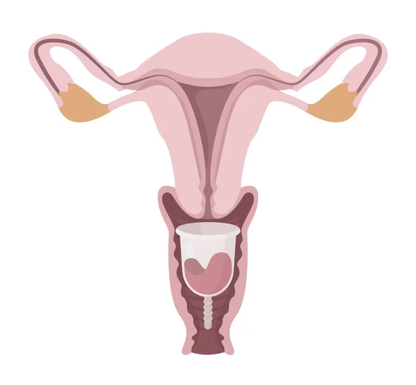 Menstruační pohár uvnitř ženského reprodukčního systému — Stockový vektor