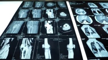 İnsan organları x-ışını ilaç fluagrofisi