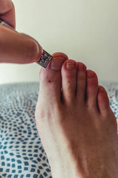 Küçük genç bir ayağın tırnaklarını keserek..