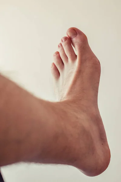 Tırnağı kırık çirkin ayaklar ve baş parmağı kıllı..